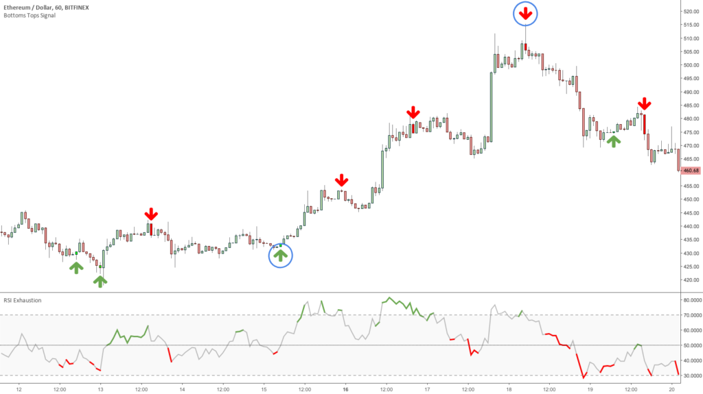 3 Trading Setups with the Bottoms Tops Signal Toolkit – Setup 1-2
